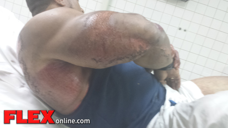 roelly_injury_2-17-14-2