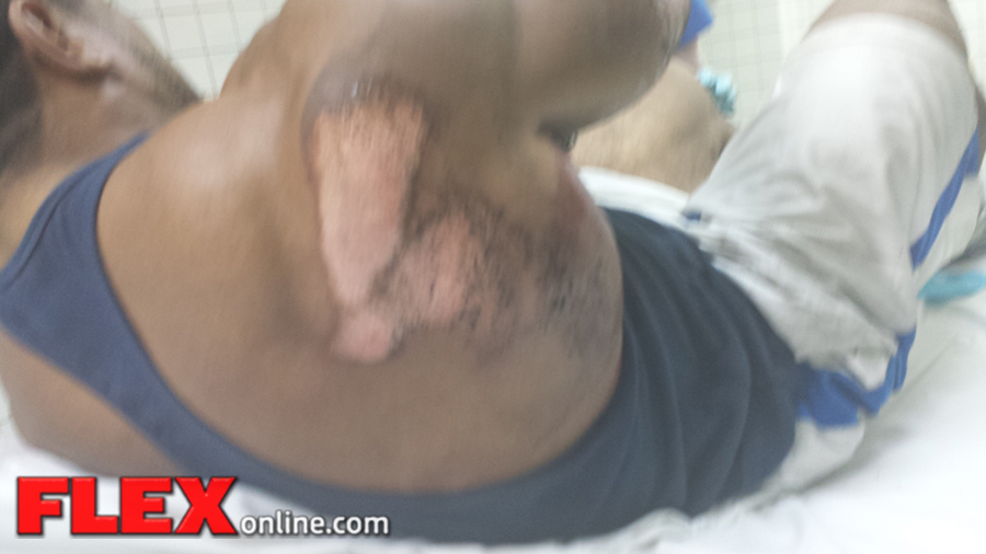 roelly_injury_2-17-14-3