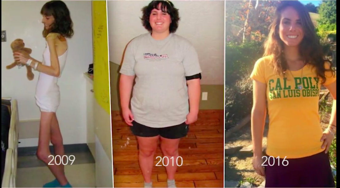 Finding Balance After Extreme Anorexia and Dangerous Binging | Muscle