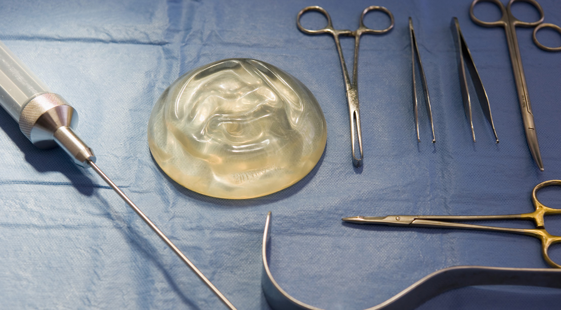 Everything You Need to Know About Breast Implants 