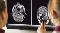 Brain-Scan-Health-Observation
