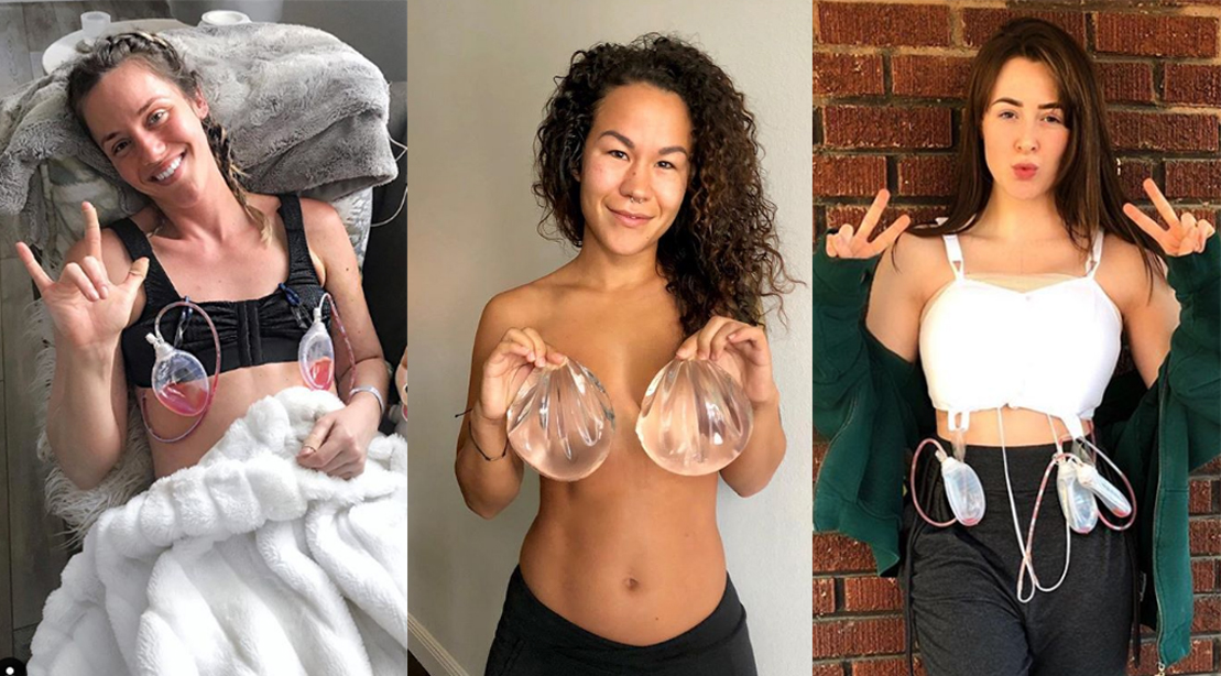 Women Are Taking to Social Media to Reclaim Their Bodies After Beating Breast Implant Illness