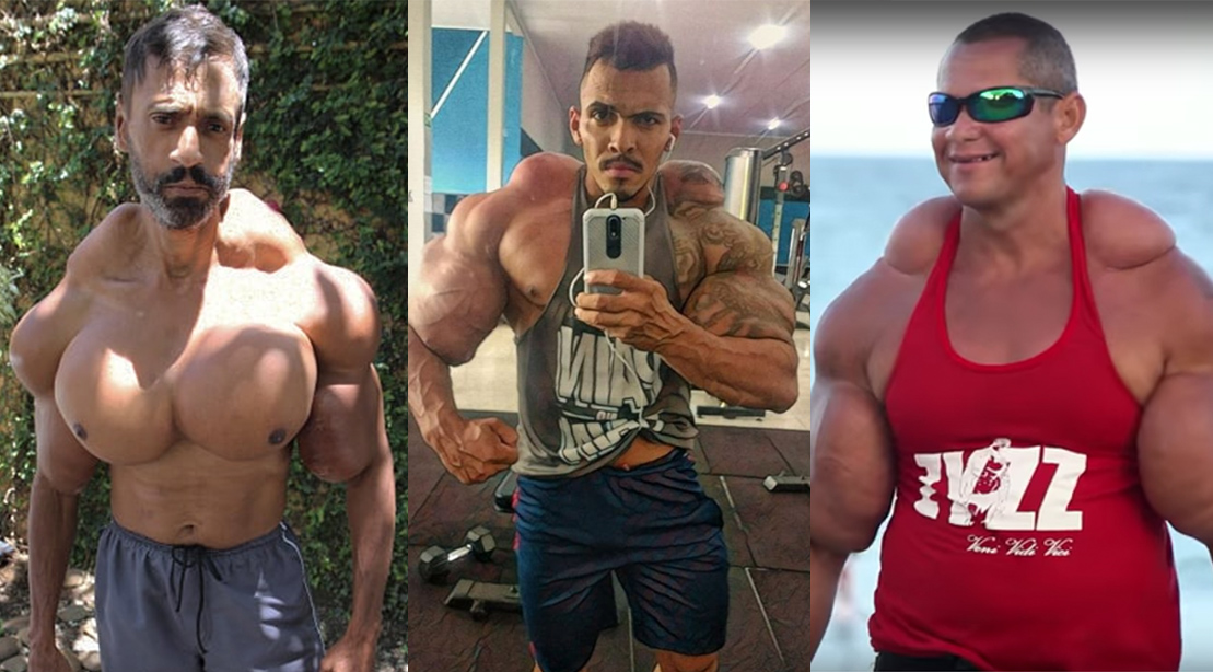 7 Alleged 'Synthol Freaks' Who Went too Far | Muscle & Fitness