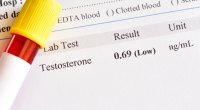 Testosterone-Blood-Test-Results-Low-Hormone