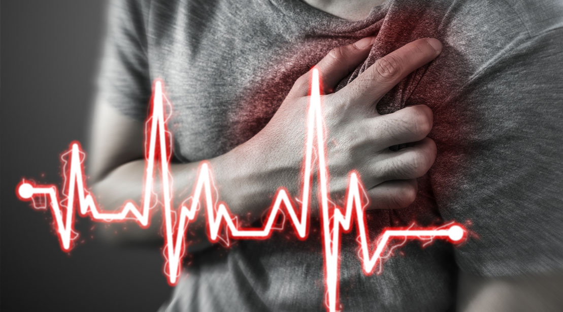 Man suffering from cardiovascular disease having chest pains leading to a heart attack