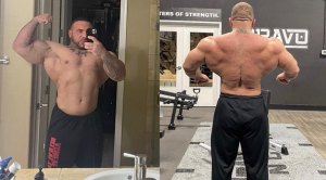 IFBB Bodybuilder Dominick Cardon skin issue due to mercury poison