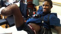 Kionte Storey recovering from his leg amputation from serving as a Marine in Afghanistan
