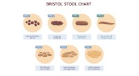 Bristol Stool Chart for your bowel movements