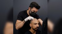 Selecting the Proper Hair Transplant Clinic in Turkey