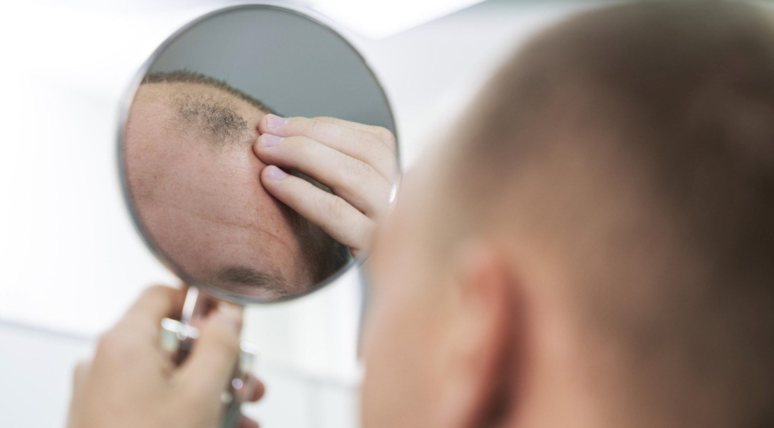 Hair Loss Myths Busted: The Function of Health in Thinning Hair Hair Loss Myths Busted: The Function of Health in Thinning Hair